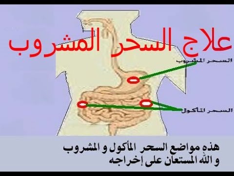 أعراض السحر المشروب و المأكول