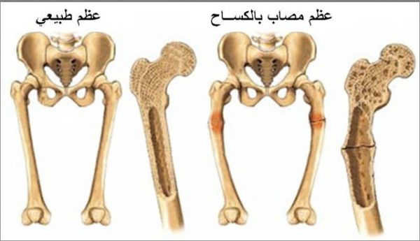 فوائد فيتامين د للرضع