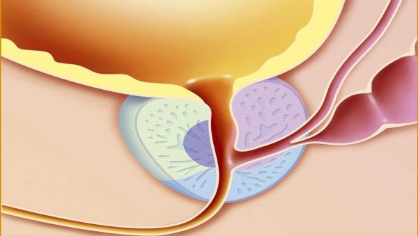 احتقان البروستاتا