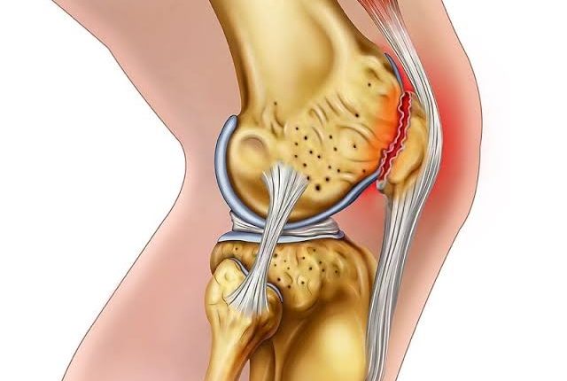 هل غضروف الركبة ينمو وكيف يتلف غضروف الركبة ؟