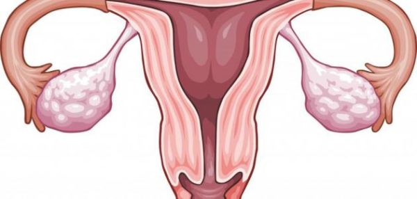 علاج للحمية الرحم بالأعشاب