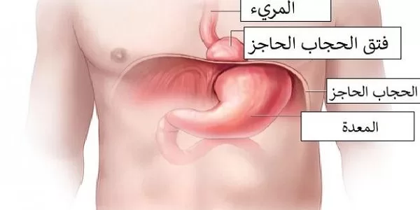 تجربتي مع عملية فتق الحجاب الحاجز